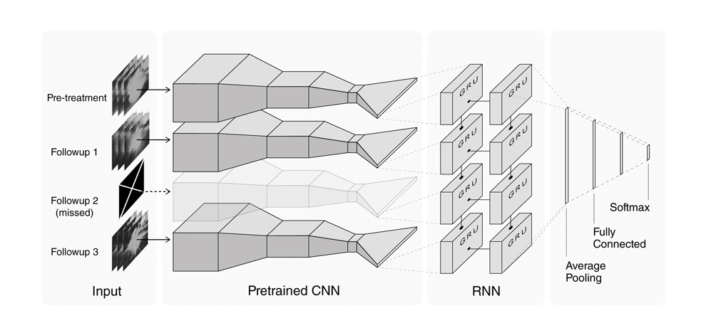 deep-learning-predicts-lung-cancer-treatment-response-from-serial-medical-imaging-3